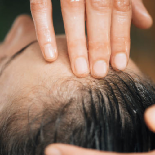 warm oil scalp massage in Toronto, Collingwood and Blue Mountain